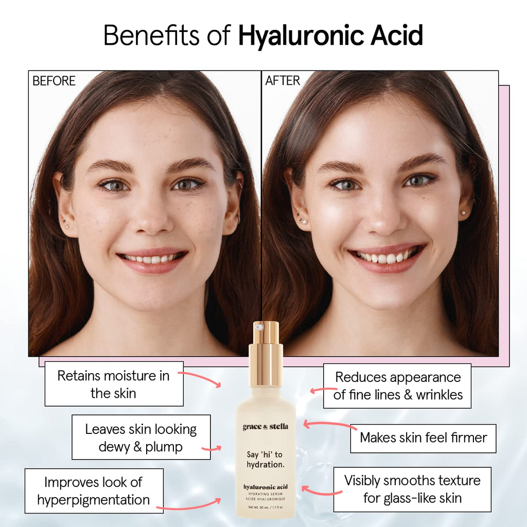grace & stella Award Winning Hyaluronic Acid Serum (50ml/1.7 fl oz) Hydrating Hyaluronic Acid Serum for Face - Acido Hialuronico for Women - Remove Fine Lines, Wrinkles, Anti Aging - Vegan Skincare